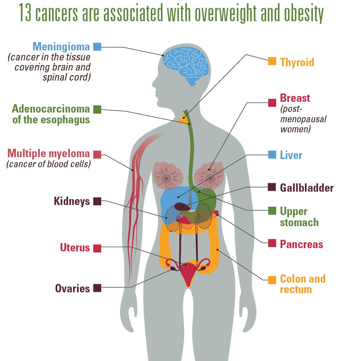 Obesity related Cancers